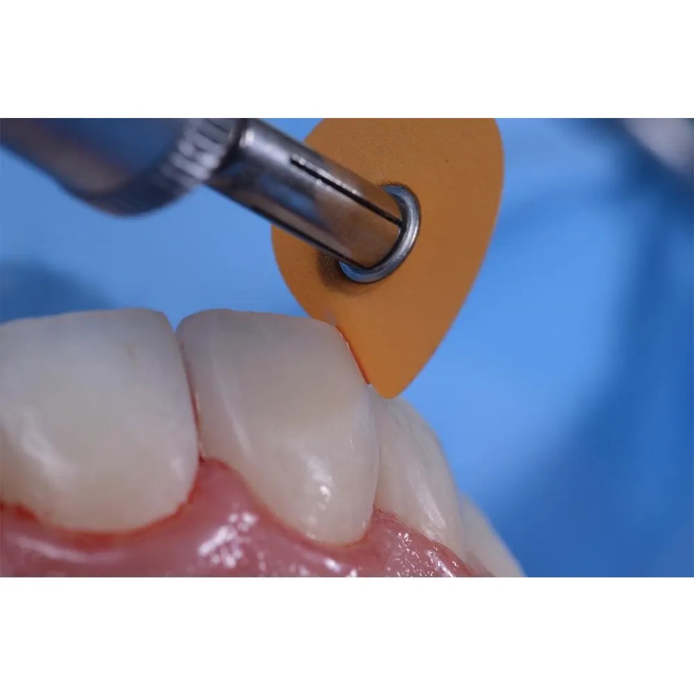 3M ESPE Sof-Lex XT Extra Thin Polishing Discs (Pack Of 30)