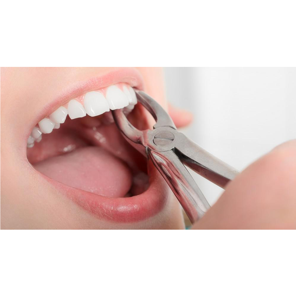 GDC Extraction Forceps Lower Anteriors And Roots - 74 Standard (FX74S)