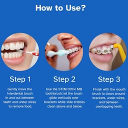 Stim Ortho Mb Brush  - 2