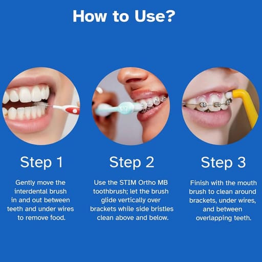 Stim Ortho Mb Brush