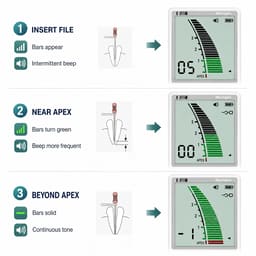 Superendo Micropex Apex Locator - 8