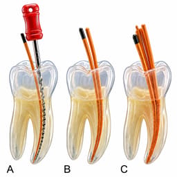 Sure Endo Gutta Percha Length Marked - 2% (Pack of 120) - 15