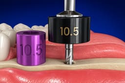 Surgident Implant Positioning Kit without Guide Stent (SD-IPO) - 5