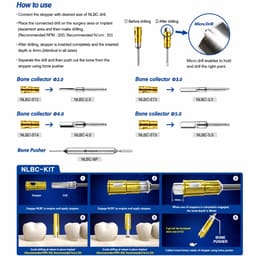 Surgident NLBC Bone Graft Kit (SD-NLBC) - 6