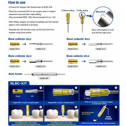 Surgident NLBC Bone Graft Kit (SD-NLBC)