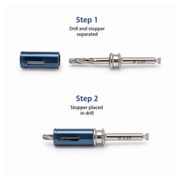 Surgident Osseodensification Sinus Expansion Drill Kit (SD-SED) - 5