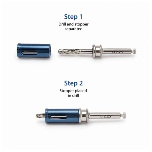 Surgident Osseodensification Sinus Expansion Drill Kit (SD-SED)