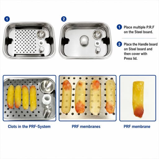 Surgident PRF System Box (SD-PRF)