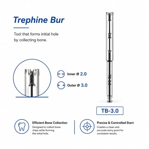 Surgident TOP System for Implant Placement Post Extraction (SD-TOP)