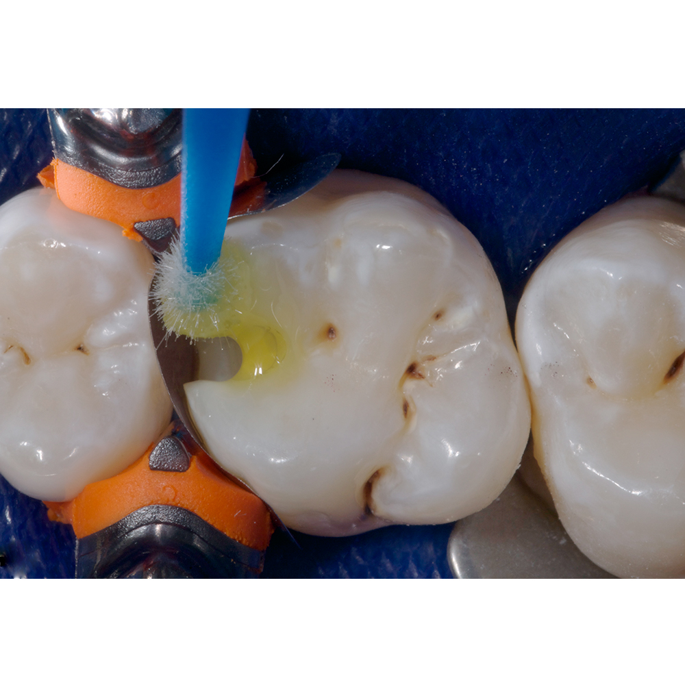 Ivoclar Vivadent Te-Econom Bond