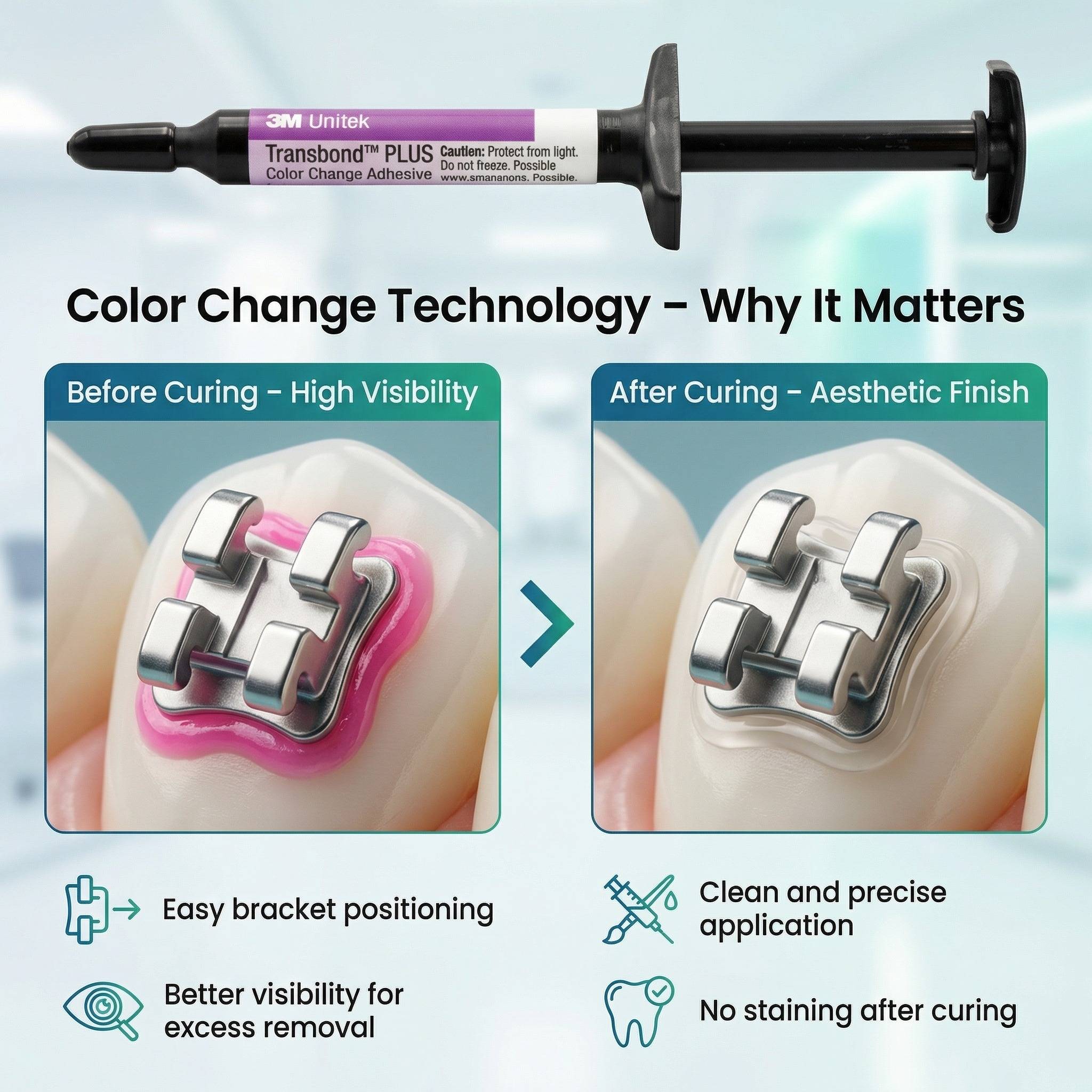 3M Unitek Transbond Plus Colour Change Syringe Refill (Pack of 4)