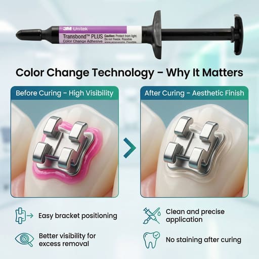 3M Unitek Transbond Plus Colour Change Syringe Refill (Pack of 4)