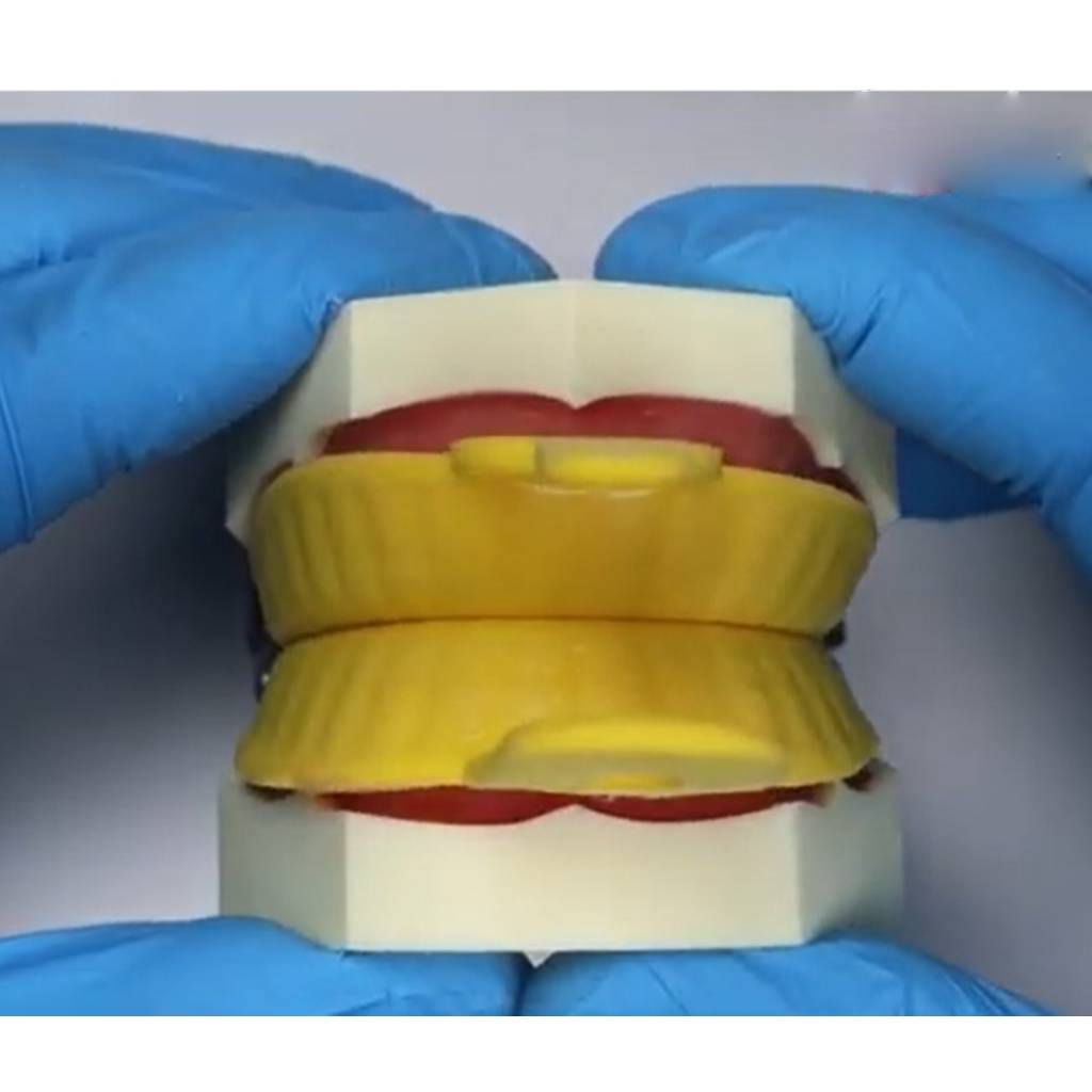 Vishal Dentocare Fluorovil Gel -Strawberry