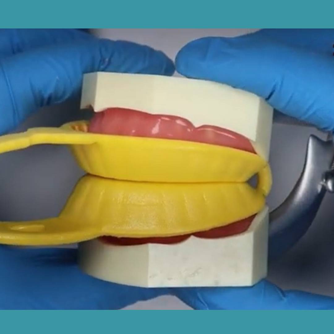 Cotisen Disposable Fluoride Foam Tray Yellow - M