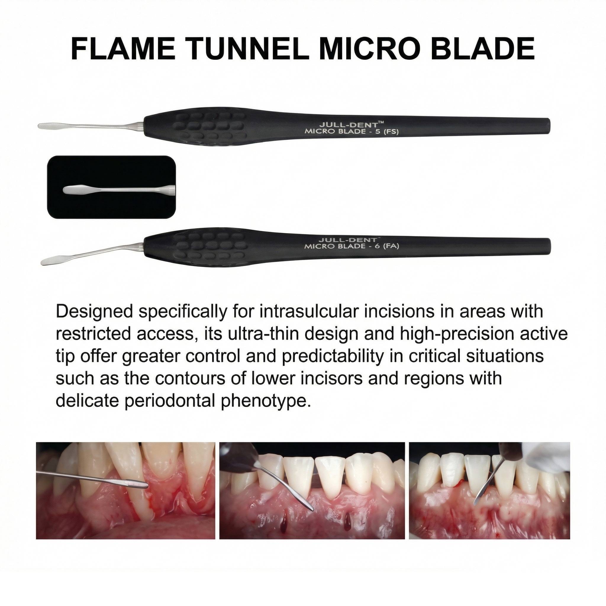 Julldent Micro Tunnel Blade (JULL-DENT 183)