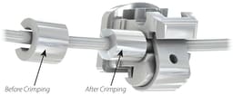 OrthoMetric SS Orthodontic Stops - 6
