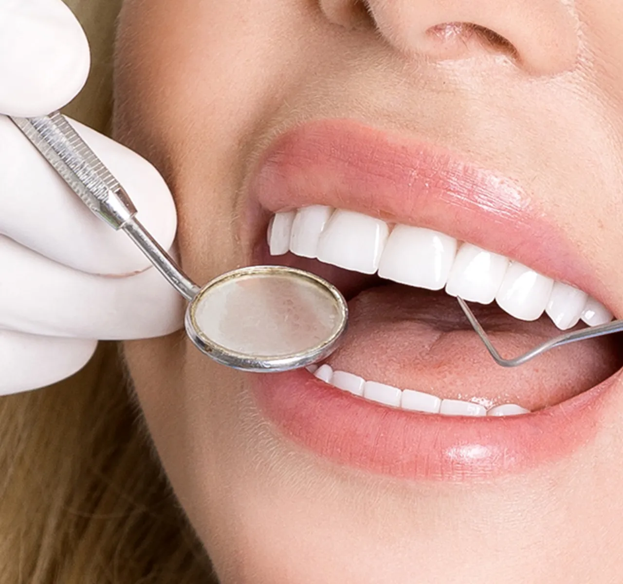 GDC Single End Probe -1 (Exs9)