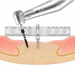 Waldent Implant Positioning Ruler (19/172) - 8