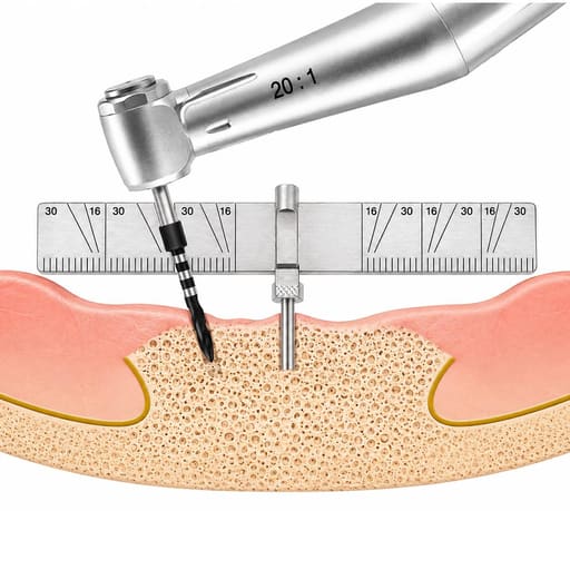 Waldent Implant Positioning Ruler (19/172)
