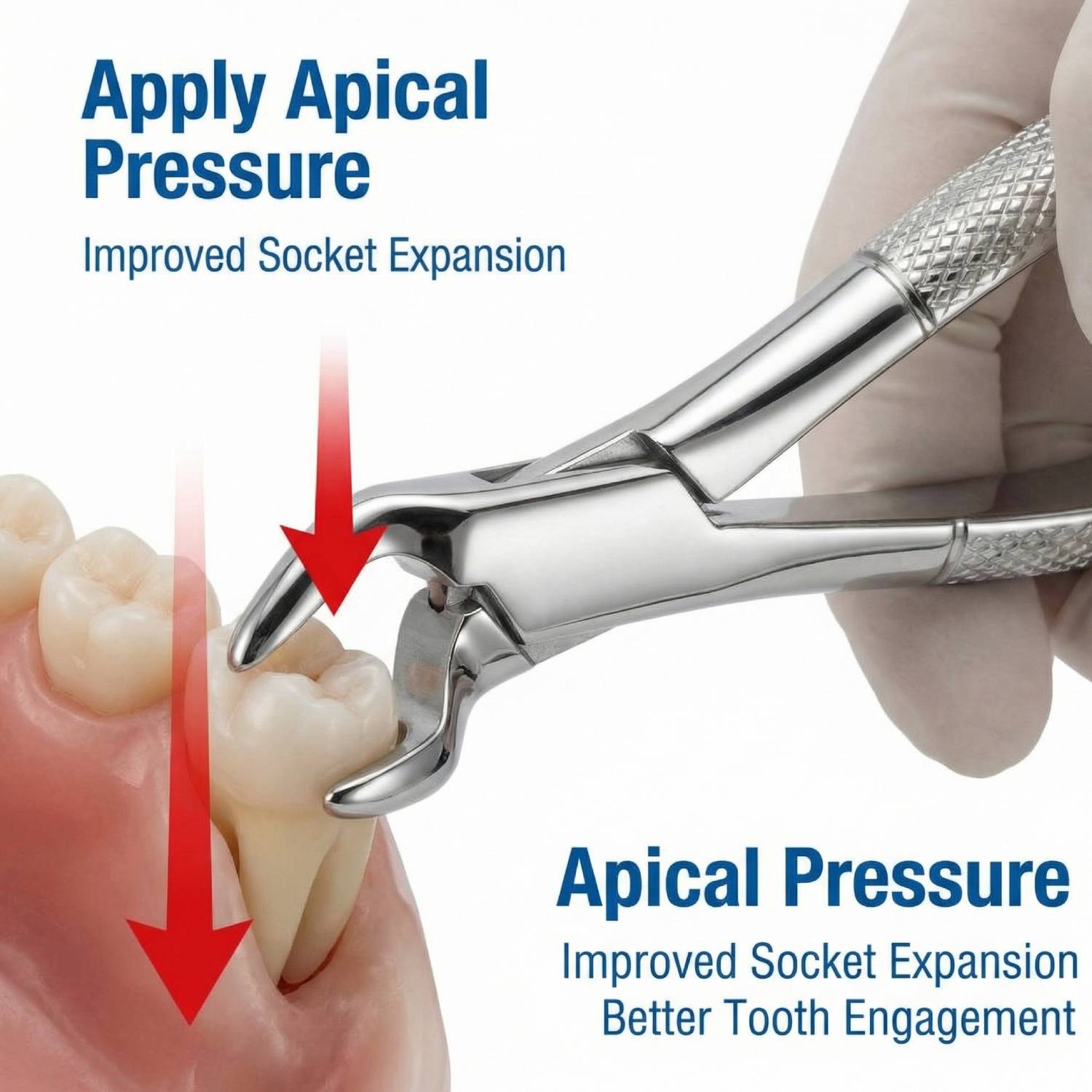 GDC American Forcep Nevius First & Second Upper Molar Teeth Right # 88R (F88R)