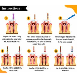 DentsMind InnoTaper NiTi Gold Rotary Files 21mm - E2 (Pack of 6) - 5