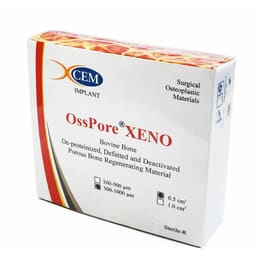 Xcem O
