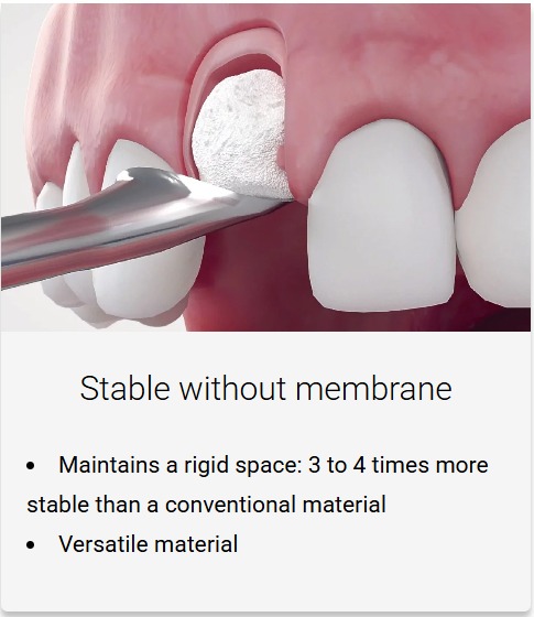 MedPark S1 Bone Graft | Xenograft | Powder Type | 0.25gm | 0.2mm-1.0mm