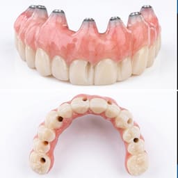 Dentaltech Dentium Compatible Multi Unit Ti Base - 8