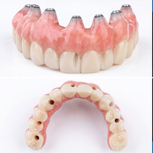 Dentaltech Dentium Compatible Multi Unit Ti Base