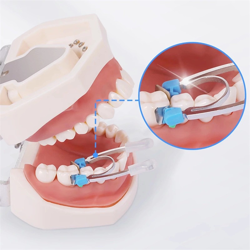Hn Dental Twin Force Kit Sectional Matrix System