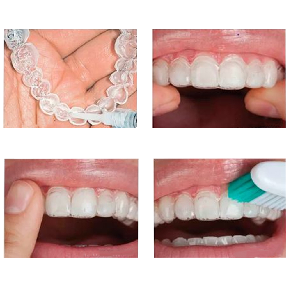 Maarc D Sens P (Desensitizing Agent with Potassium Nitrate) (3020/003)