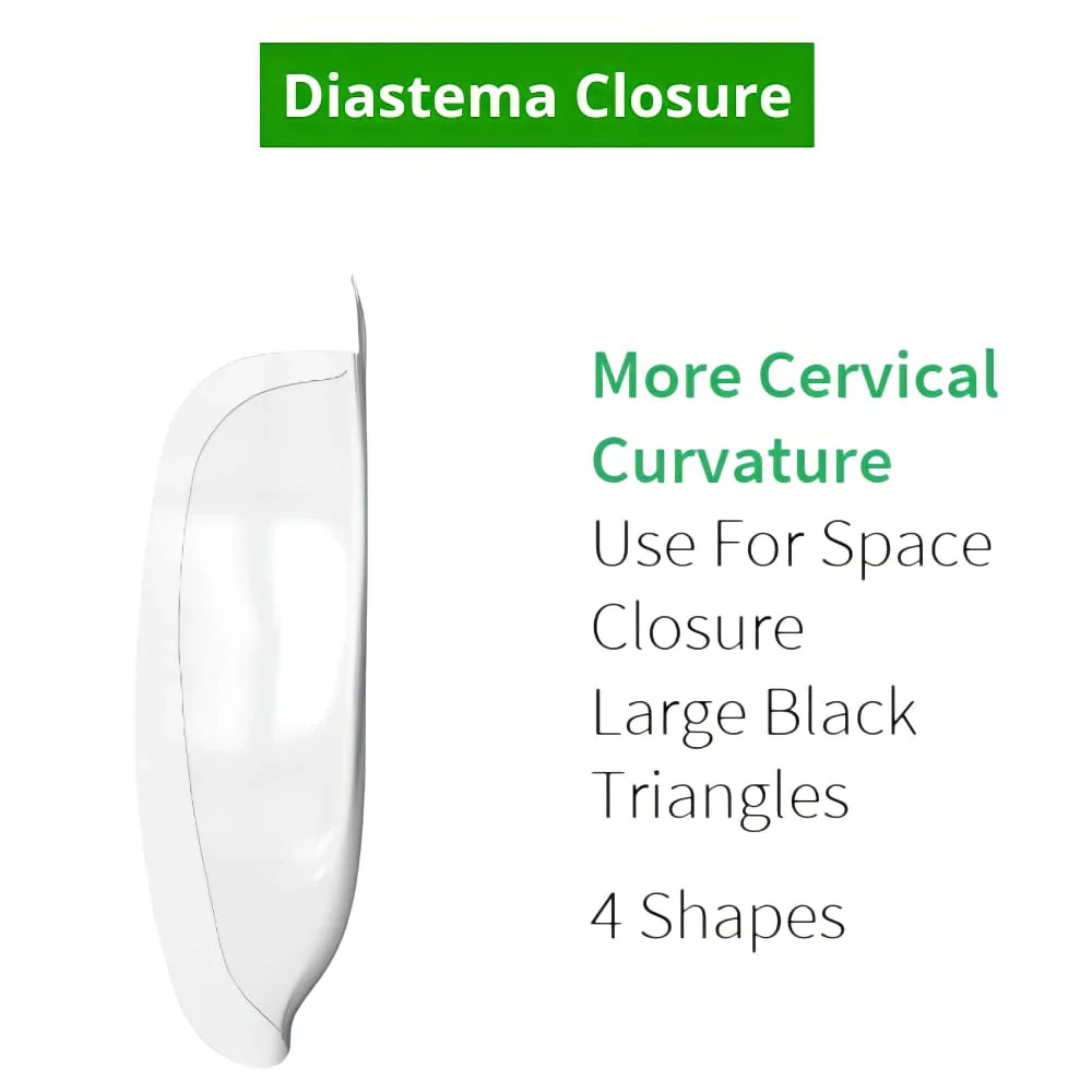 Bioclear Diastema Matrix Closure Series