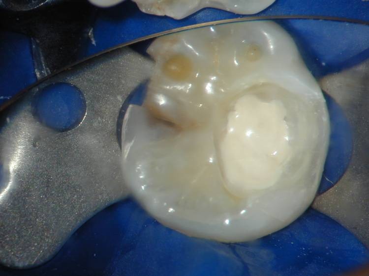 Ammdent Lc Cal Excel