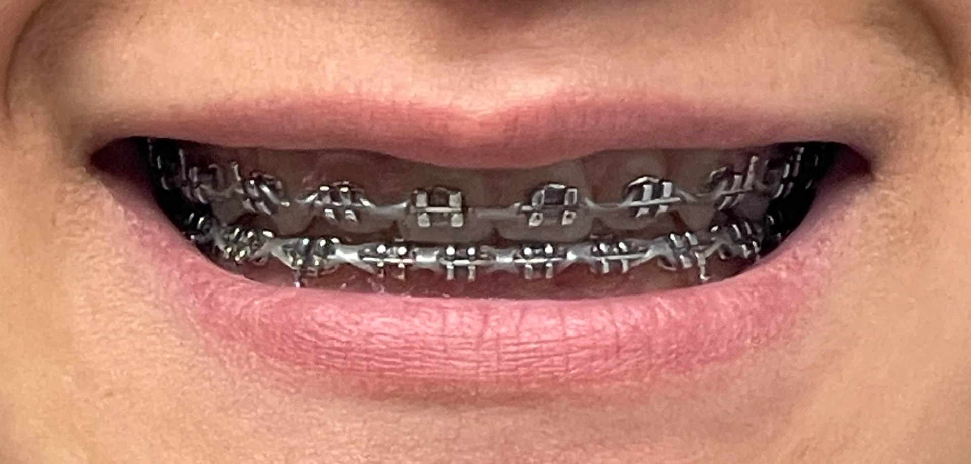 U Ortho E-Chain (15 ft) - Short Grey