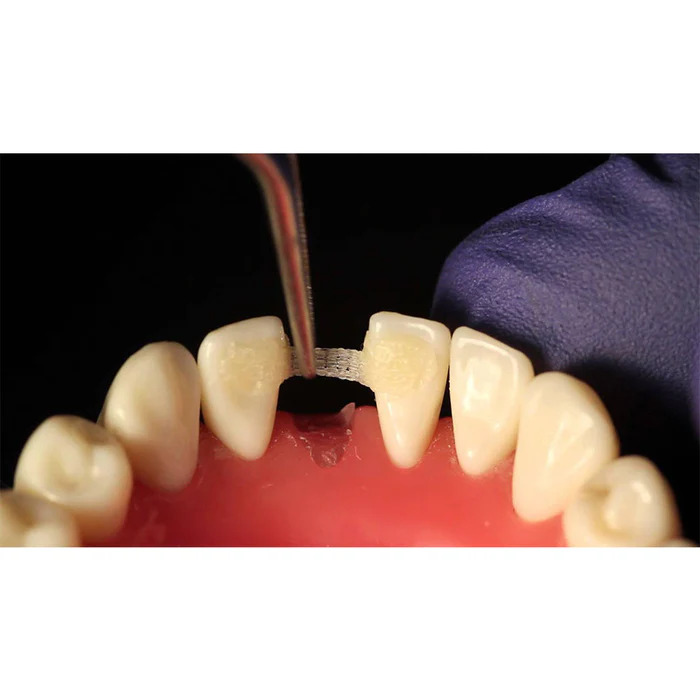 DentAct Fiber Splint 14cm