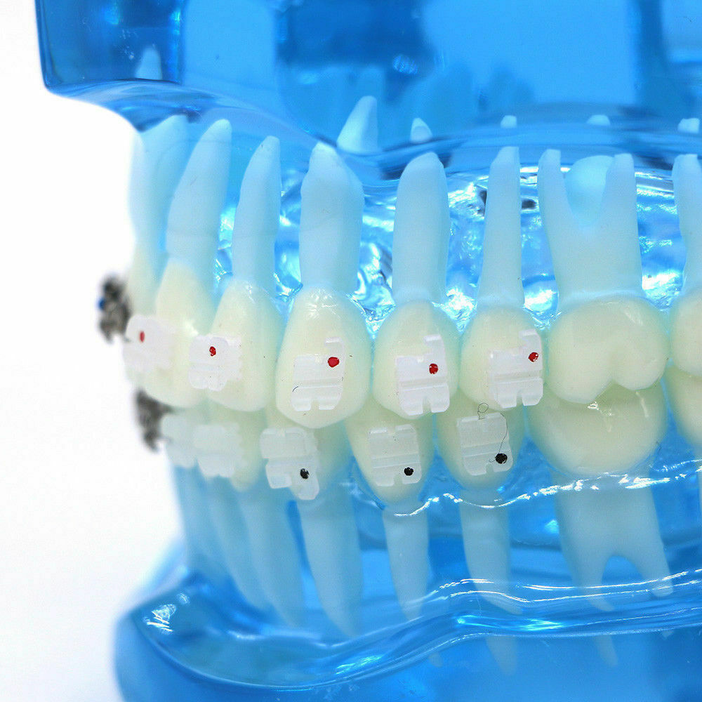 iDENTical Half Metal and Half Ceramic Brackets Orthodontic Models M3003