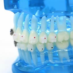 iDENTical Half Metal and Half Ceramic Brackets Orthodontic Models M3003 - 13