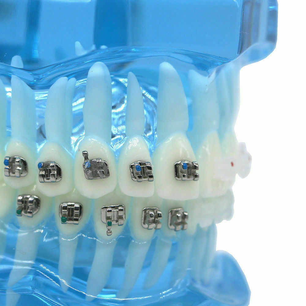 iDENTical Half Metal and Half Ceramic Brackets Orthodontic Models M3003