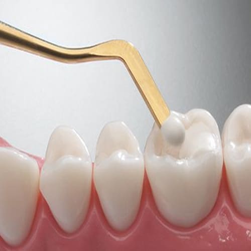 GDC Composite Instrument Flexi Thin Gold Titanium - 6 (CIGFT1)