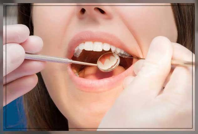 Hahnenkratt TOPvision FS Rhodium Mouth Mirrors