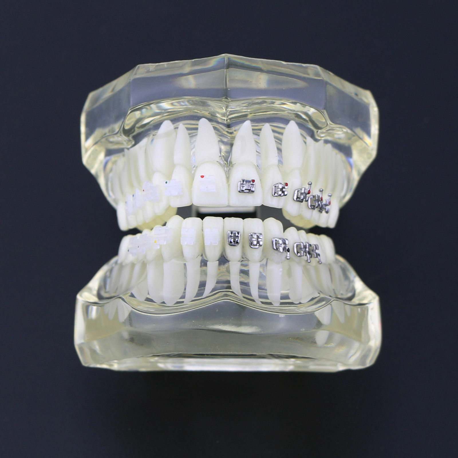 iDENTical Half Metal and Half Ceramic Brackets Orthodontic Models M3003