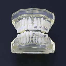 iDENTical Half Metal and Half Ceramic Brackets Orthodontic Models M3003 - 16