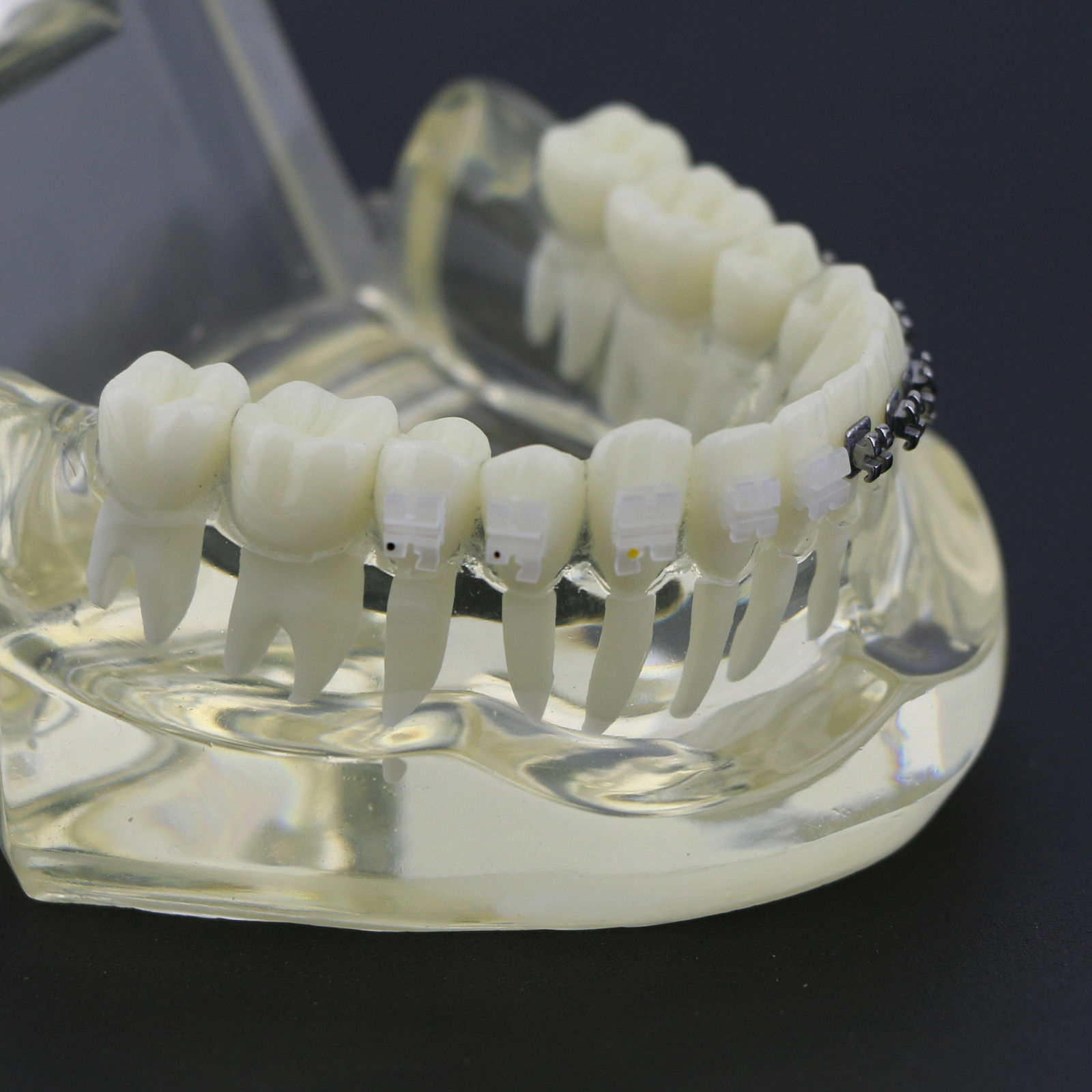 iDENTical Half Metal and Half Ceramic Brackets Orthodontic Models M3003