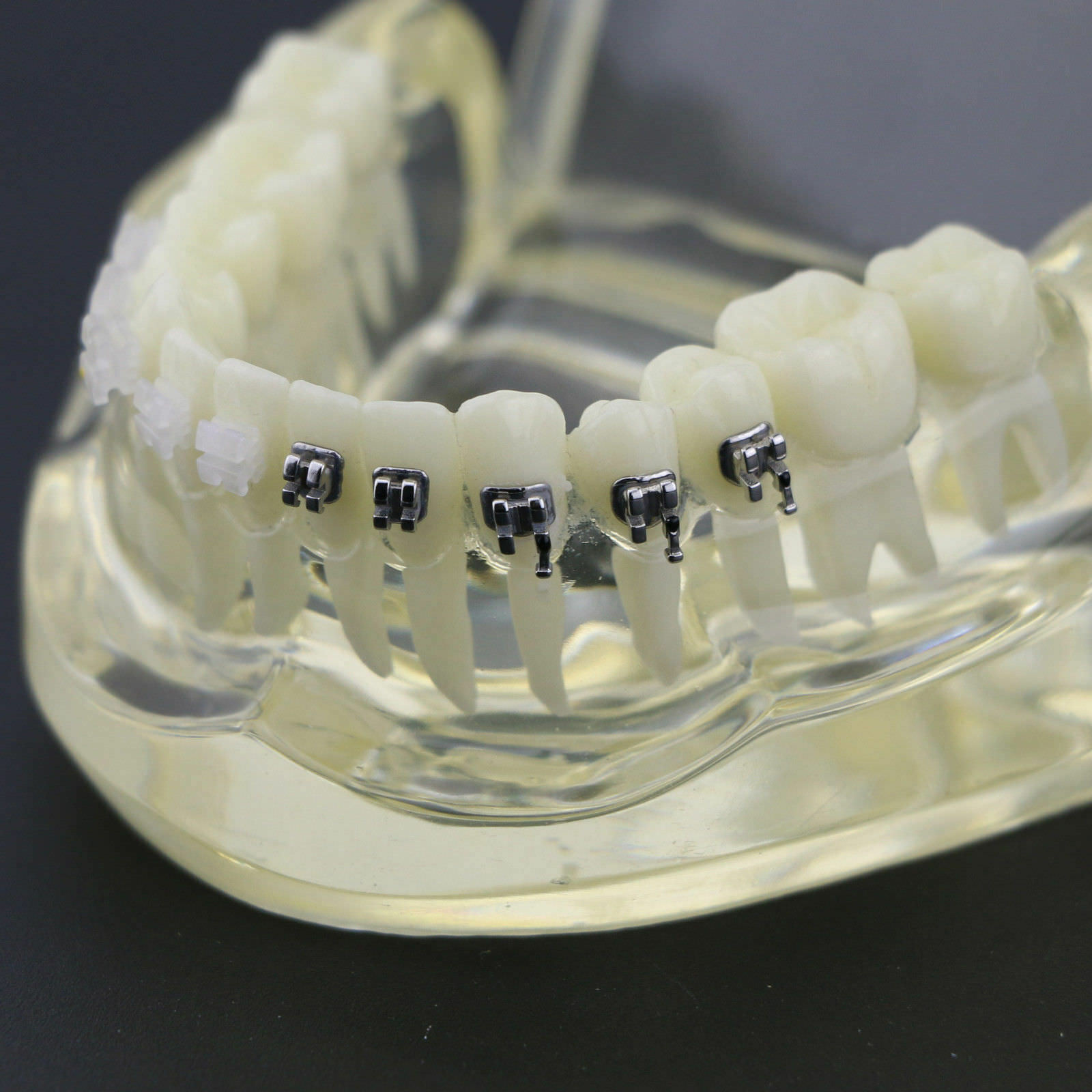 iDENTical Half Metal and Half Ceramic Brackets Orthodontic Models M3003