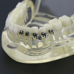 iDENTical Half Metal and Half Ceramic Brackets Orthodontic Models M3003 - 18