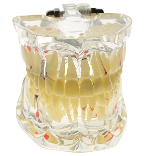 iDENTical Adult Pathologies Model M4001-1