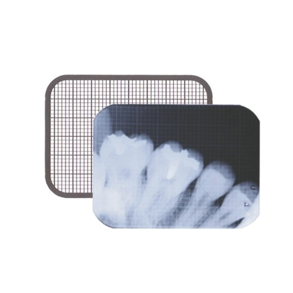 Dental IOPA X-Ray Grid