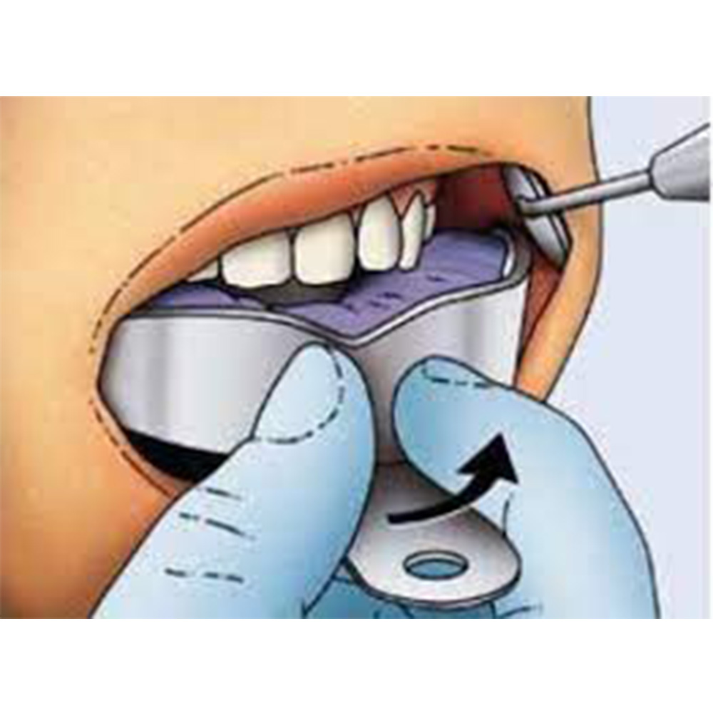 GDC Impression Trays Dentulous Non-Perforated S/8 Instruments Kit (ITRLDNPP8)