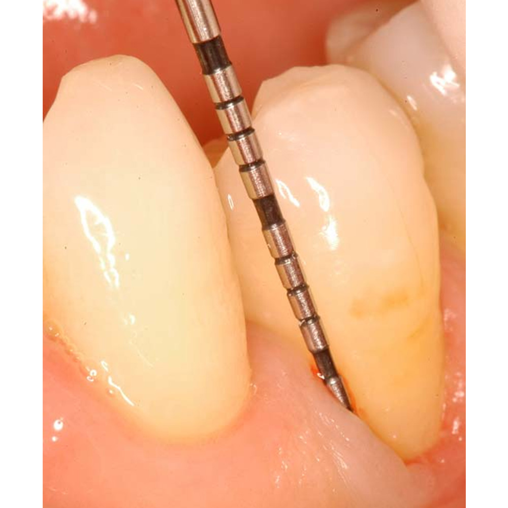 GDC Explorer With PCPUNC15 # 6 (EXP23/UNC15)