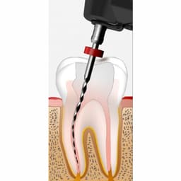Woodpecker Endomatic Endomotor - 5